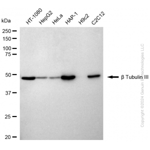 KD-Validated TUBB3 Rabbit mAb (20 μl)