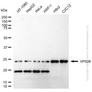 KD-Validated VPS28 Rabbit mAb (20 μl)