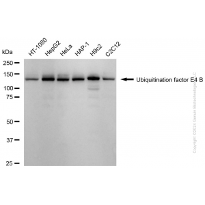 KD-Validated UBE4B Rabbit mAb (20 μl)