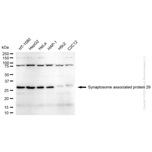 KD-Validated SNAP29 Rabbit mAb (20 μl)