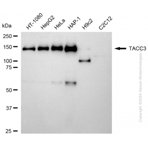 KD-Validated TACC3 Rabbit mAb (20 μl)