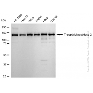 KD-Validated TPP2 Rabbit mAb (20 μl)