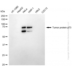 KD-Validated TP73 Rabbit mAb (20 μl)