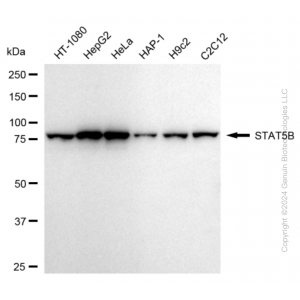 KD-Validated STAT5B Rabbit mAb (20 μl)