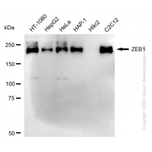 KD-Validated ZEB1 Rabbit mAb (20 μl)