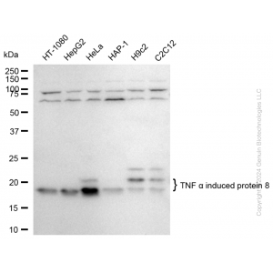 KD-Validated TNFAIP8 Rabbit mAb (20 μl)