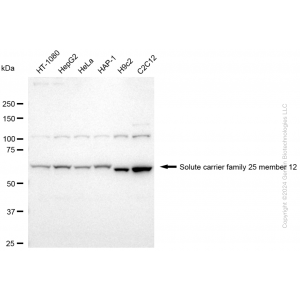 KD-Validated SLC25A12 Rabbit mAb (20 μl)