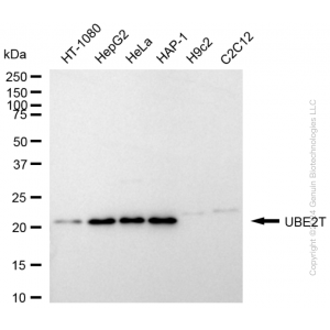 KD-Validated UBE2T Rabbit mAb (20 μl)