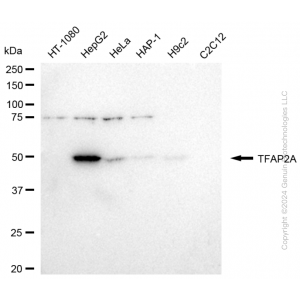 KD-Validated TFAP2A Rabbit mAb (20 μl)