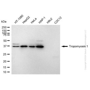 KD-Validated TPM1 Rabbit mAb (20 μl)