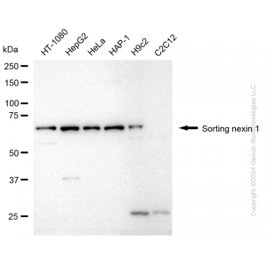 KD-Validated SNX1 Rabbit mAb (20 μl)