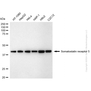 KD-Validated SSTR5 Rabbit mAb (20 μl)