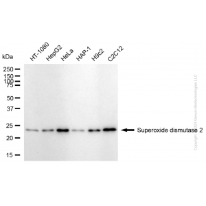KD-Validated SOD2 Rabbit mAb (20 μl)