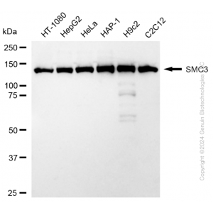 KD-Validated SMC3 Rabbit mAb (20 μl)