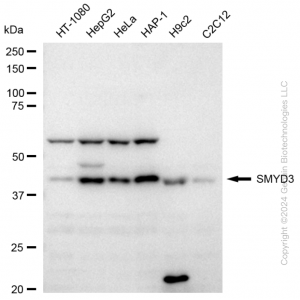 KD-Validated SMYD3 Rabbit mAb (20 μl)