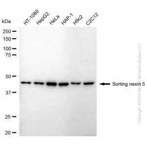 KD-Validated SNX5 Rabbit mAb (20 μl)