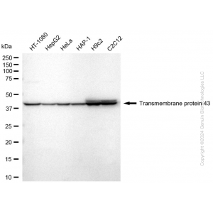 KD-Validated TMEM43 Rabbit mAb (20 μl)