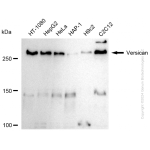 KD-Validated VCAN Rabbit mAb (20 μl)