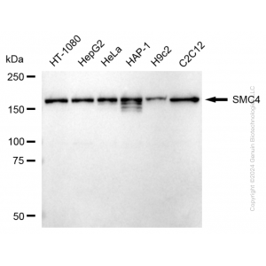 KD-Validated SMC4 Rabbit mAb (20 μl)