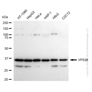 KD-Validated VPS26 Rabbit mAb (20 μl)