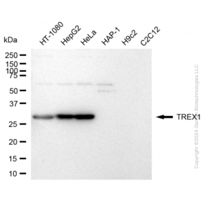 KD-Validated TREX1 Rabbit mAb (20 μl)