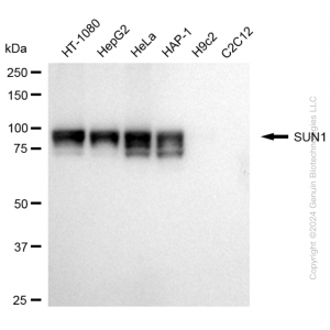 KD-Validated SUN1 Rabbit mAb (20 μl)