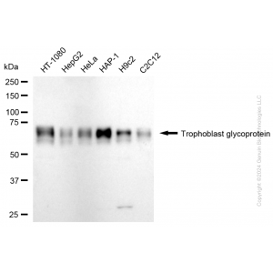 KD-Validated TPBG Rabbit mAb (20 μl)