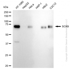 KD-Validated SOX9 Rabbit mAb (20 μl)