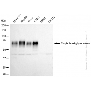 KD-Validated TPBG Rabbit mAb (20 μl)