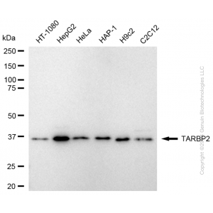 KD-Validated TARBP2 Rabbit mAb (20 μl)