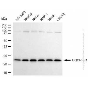 KD-Validated UQCRFS1 Rabbit mAb (20 μl)
