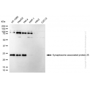 KD-Validated SNAP25 Rabbit mAb (20 μl)