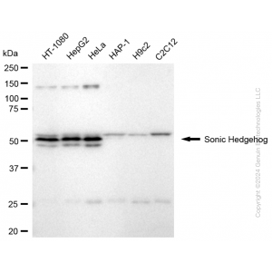 KD-Validated SHH Rabbit mAb (20 μl)