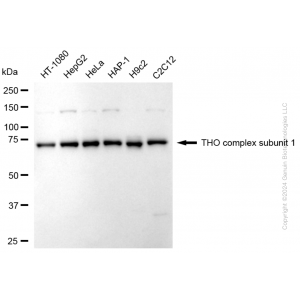 KD-Validated THOC1 Rabbit mAb (20 μl)