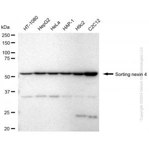 KD-Validated SNX4 Rabbit mAb (20 μl)