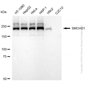 KD-Validated SMCHD1 Rabbit mAb (20 μl)