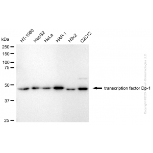 KD-Validated TFDP1 Rabbit mAb (20 μl)