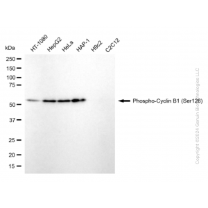 KD-Validated Phospho-CCNB1 (Ser126) Rabbit mAb (20 μl)