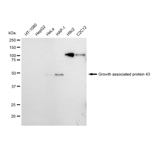 KD-Validated GAP43 Rabbit mAb (20 μl)