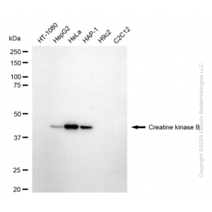 KD-Validated CKB type Rabbit mAb (20 μl)