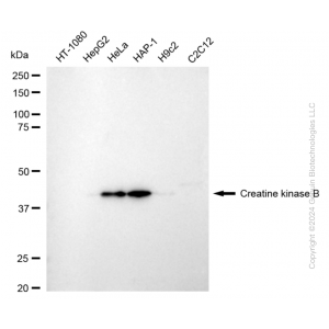 KD-Validated CKB type Rabbit mAb (20 μl)