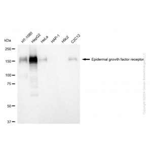 KD-Validated EGFR Rabbit mAb (20 μl)