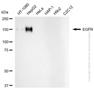 KD-Validated EGFR Rabbit mAb (20 μl)