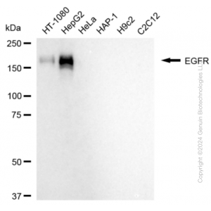 KD-Validated EGFR Rabbit mAb (20 μl)