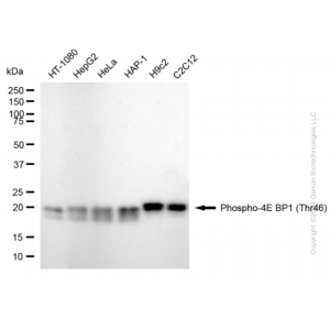 KD-Validated Phospho-EIF4EBP1 (Thr46) Rabbit mAb (20 μl)