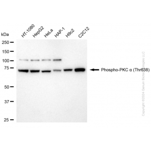 KD-Validated Phospho-PRKCA (Thr638) Rabbit mAb (20 μl)
