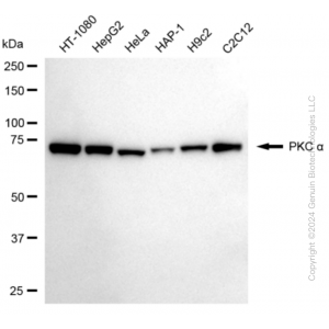 KD-Validated PRKCA Rabbit mAb (20 μl)