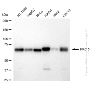 KD-Validated PRKCD Rabbit mAb (20 μl)