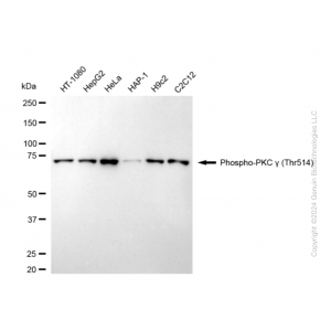 KD-Validated Phospho-PRKCG (Thr514) Rabbit mAb (20 μl)