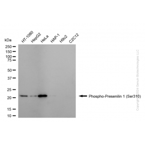 KD-Validated Phospho-PSEN1 (Ser310) Rabbit mAb (20 μl)